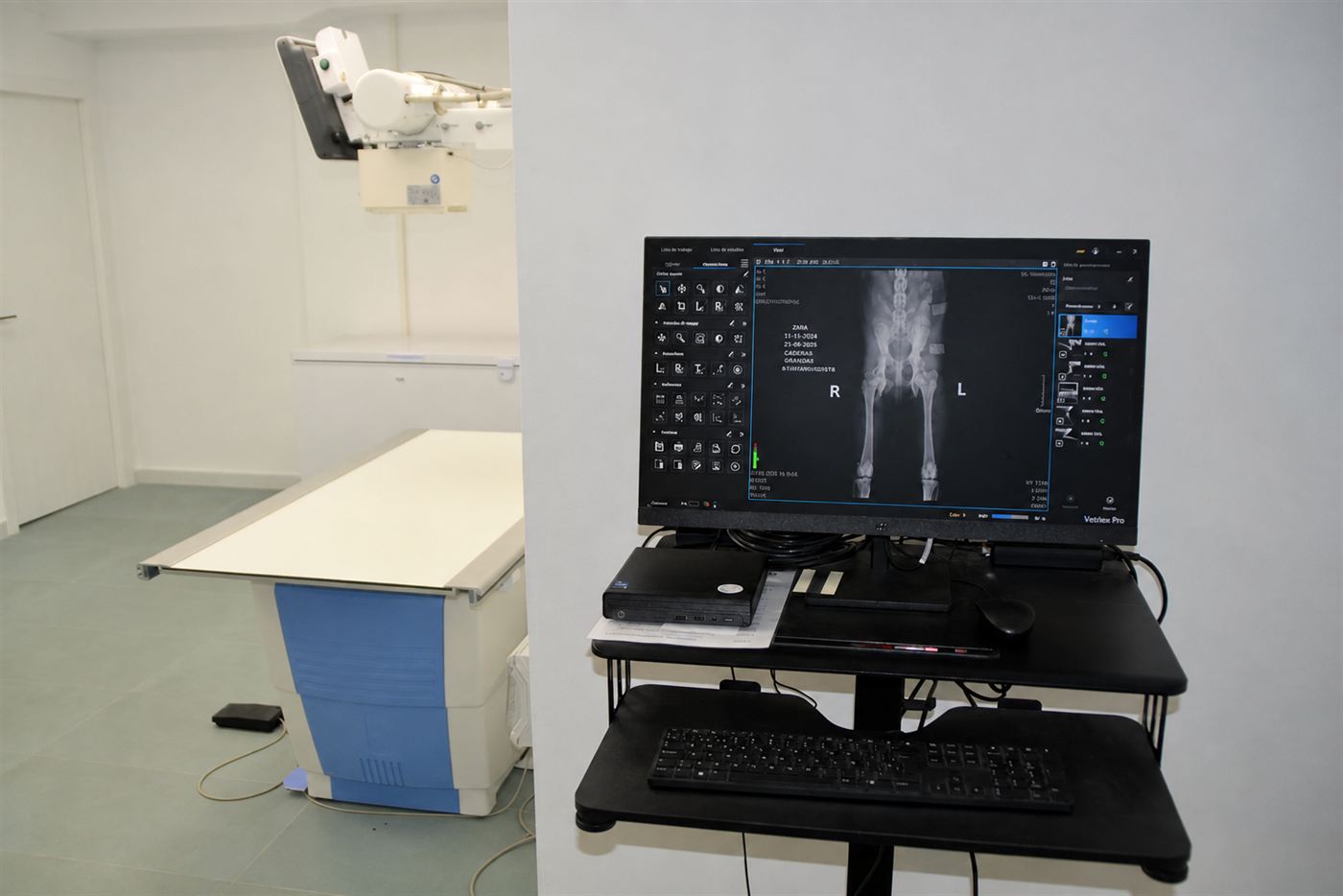 Sala de raigs X digital amb l'estació de diagnòstic per imatge